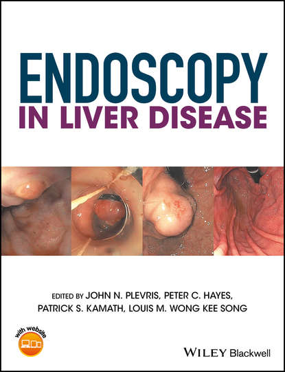 Скачать книгу Endoscopy in Liver Disease