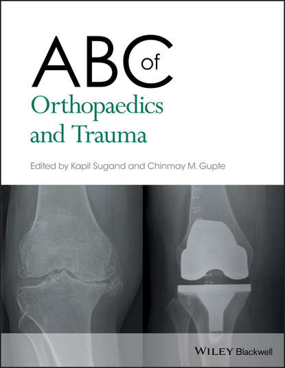 Скачать книгу ABC of Orthopaedics and Trauma