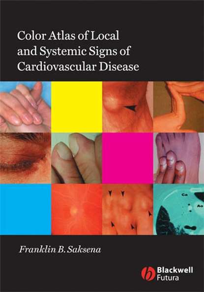 Скачать книгу Color Atlas of Local and Systemic Manifestations of Cardiovascular Disease