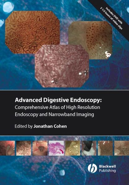 Скачать книгу Comprehensive Atlas of High Resolution Endoscopy and Narrowband Imaging