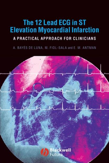 Скачать книгу The 12 Lead ECG in ST Elevation Myocardial Infarction