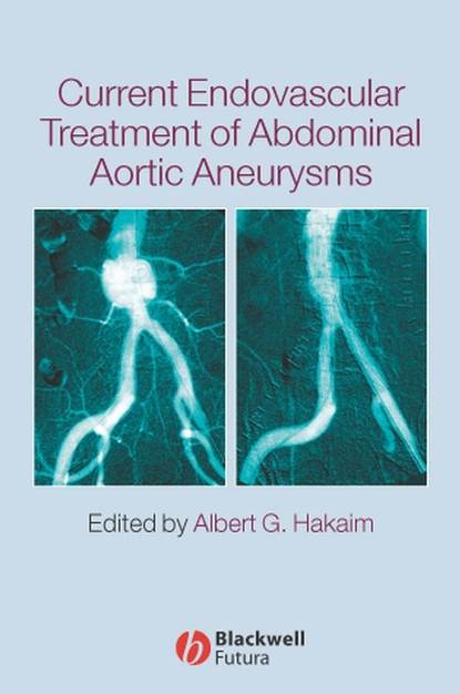 Скачать книгу Current Endovascular Treatment of Abdominal Aortic Aneurysms
