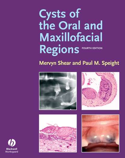 Скачать книгу Cysts of the Oral and Maxillofacial Regions