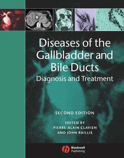 Скачать книгу Diseases of the Gallbladder and Bile Ducts