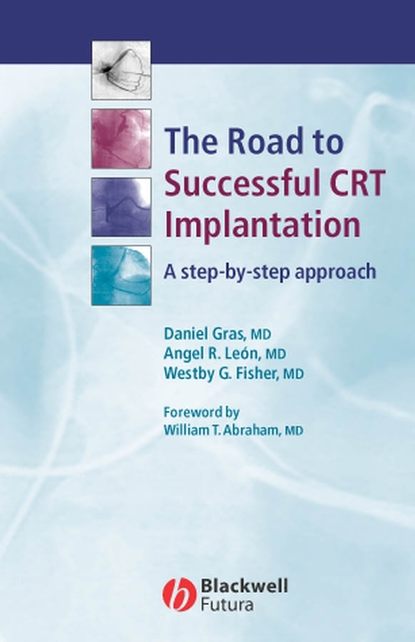 Скачать книгу The Road to Successful CRT System Implantation