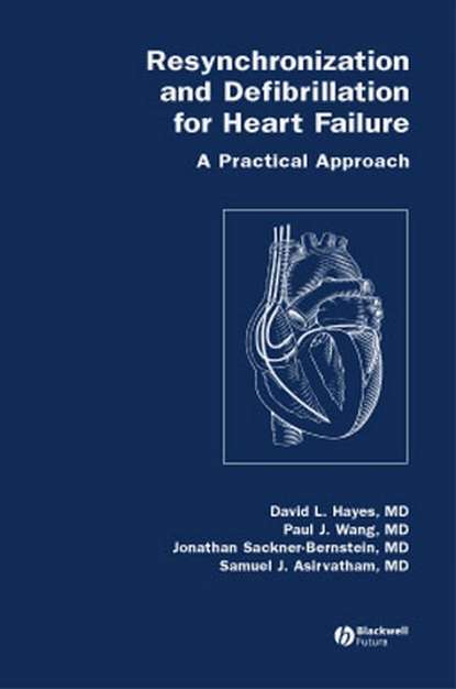 Скачать книгу Resynchronization and Defibrillation for Heart Failure