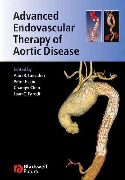 Скачать книгу Advanced Endovascular Therapy of Aortic Disease
