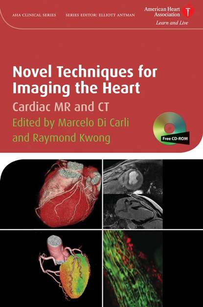 Скачать книгу Novel Techniques for Imaging the Heart
