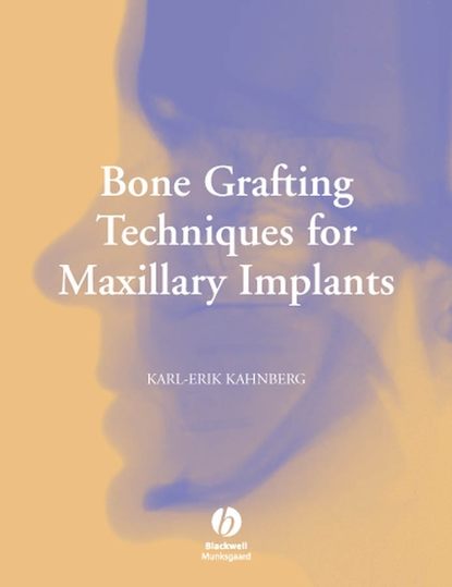 Скачать книгу Bone Grafting Techniques for Maxillary Implants