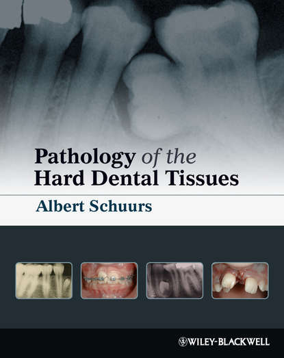 Скачать книгу Pathology of the Hard Dental Tissues