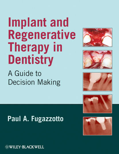 Скачать книгу Implant and Regenerative Therapy in Dentistry