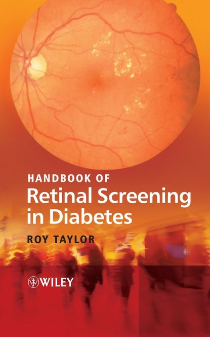 Скачать книгу Handbook of Retinal Screening in Diabetes