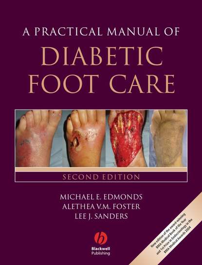 Скачать книгу A Practical Manual of Diabetic Foot Care