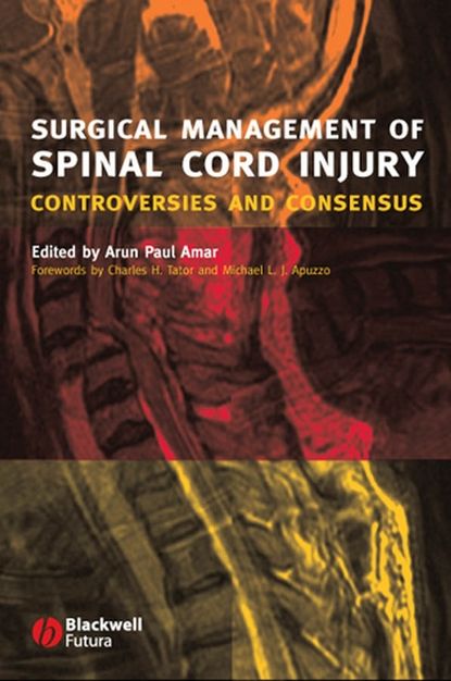 Скачать книгу Surgical Management of Spinal Cord Injury