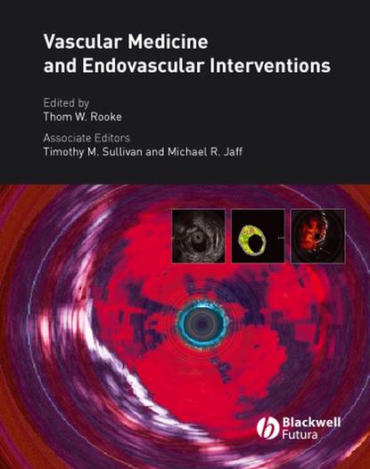 Скачать книгу Vascular Medicine and Endovascular Interventions