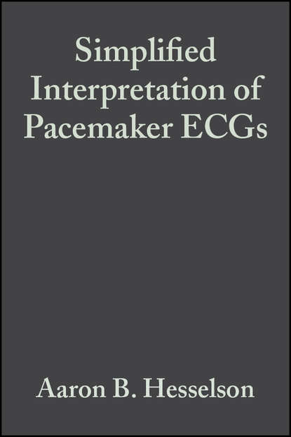 Скачать книгу Simplified Interpretation of Pacemaker ECGs