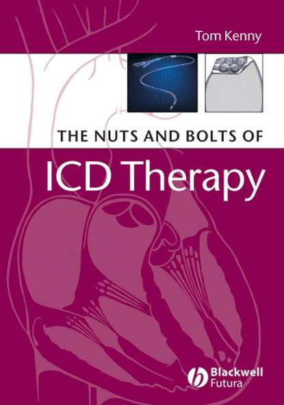 Скачать книгу The Nuts and Bolts of ICD Therapy