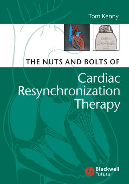 Скачать книгу The Nuts and Bolts of Cardiac Resynchronization Therapy