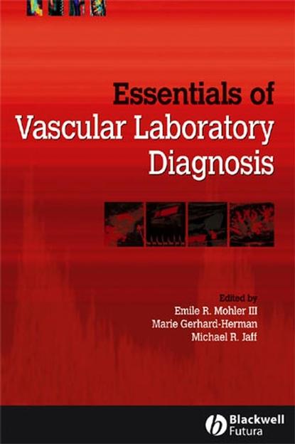 Скачать книгу Essentials of Vascular Laboratory Diagnosis