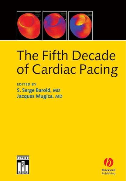 Скачать книгу The Fifth Decade of Cardiac Pacing