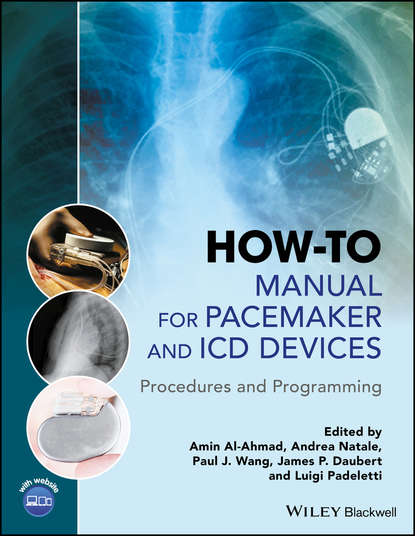 Скачать книгу How-to Manual for Pacemaker and ICD Devices