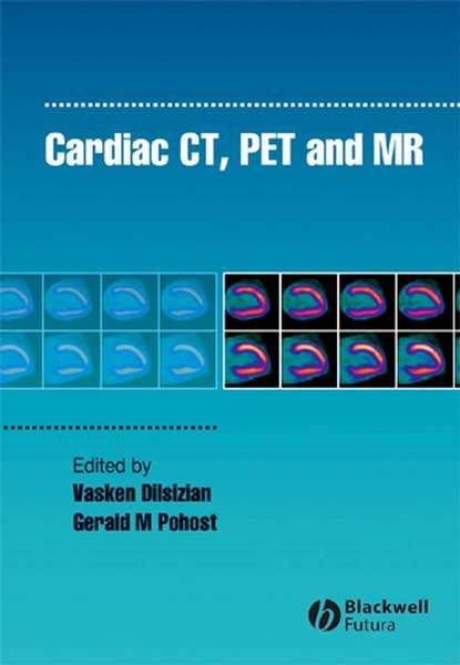 Скачать книгу Cardiac CT, PET and MR