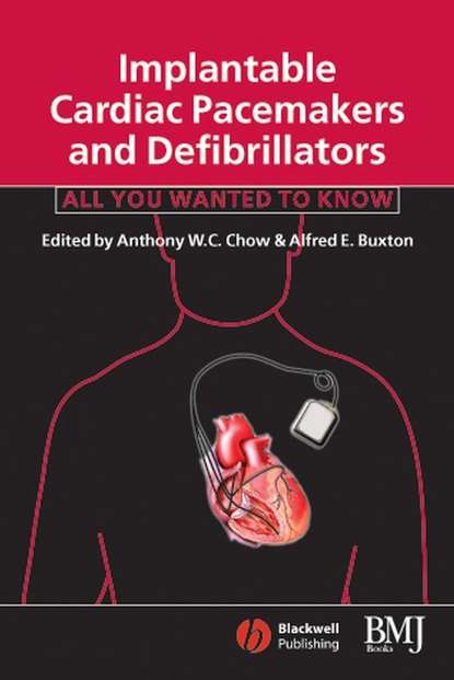 Скачать книгу Implantable Cardiac Pacemakers and Defibrillators