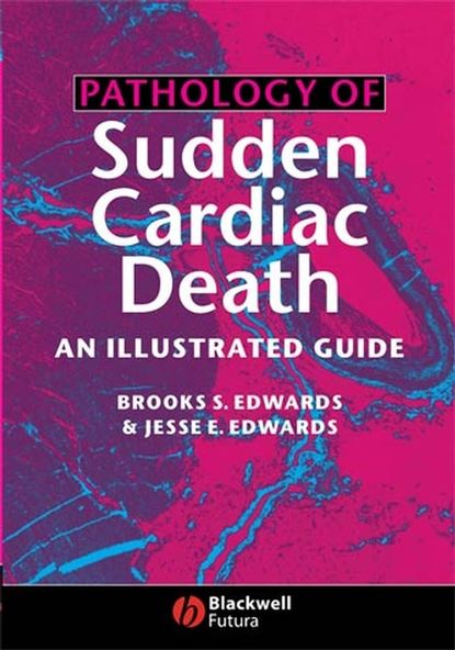 Скачать книгу Pathology of Sudden Cardiac Death