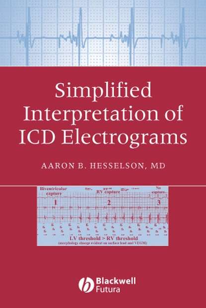 Скачать книгу Simplified Interpretation of ICD Electrograms