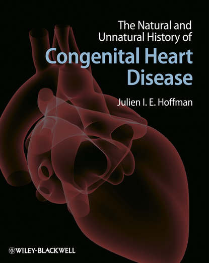 Скачать книгу The Natural and Unnatural History of Congenital Heart Disease