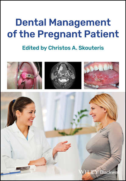 Скачать книгу Dental Management of the Pregnant Patient