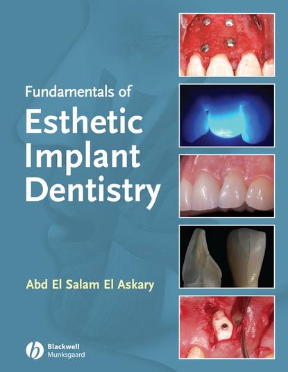Скачать книгу Fundamentals of Esthetic Implant Dentistry