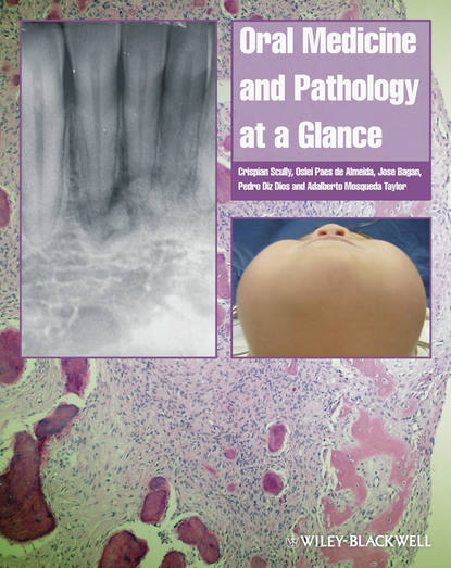 Скачать книгу Oral Medicine and Pathology at a Glance