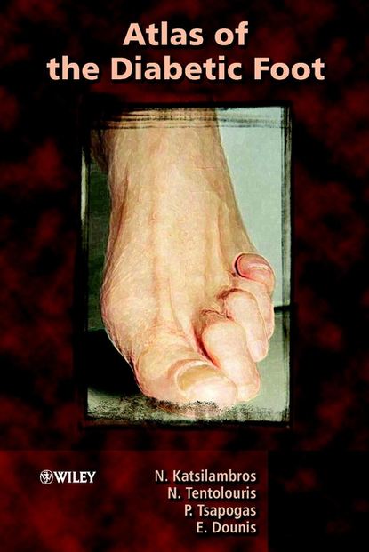 Скачать книгу Atlas of the Diabetic Foot