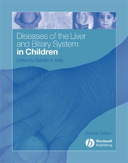 Скачать книгу Diseases of the Liver and Biliary System in Children