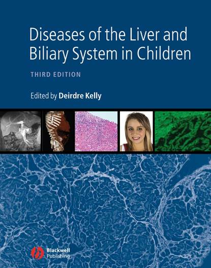 Скачать книгу Diseases of the Liver and Biliary System in Children