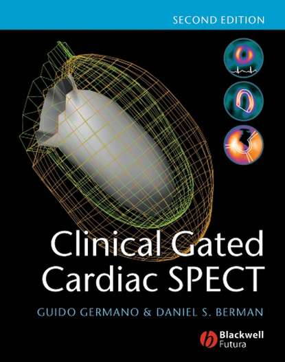 Скачать книгу Clinical Gated Cardiac SPECT