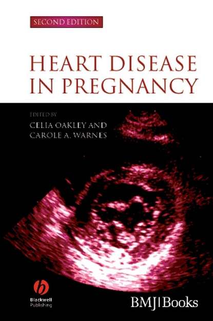Скачать книгу Heart Disease in Pregnancy