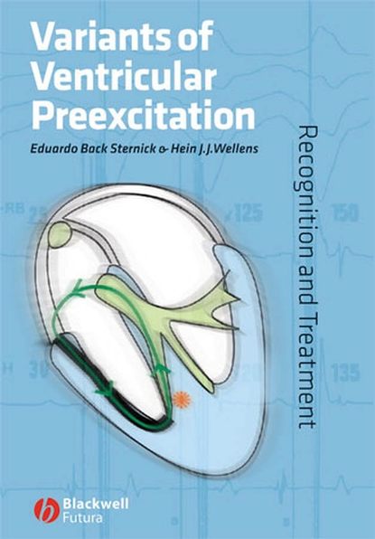 Скачать книгу Variants of Ventricular Preexcitation