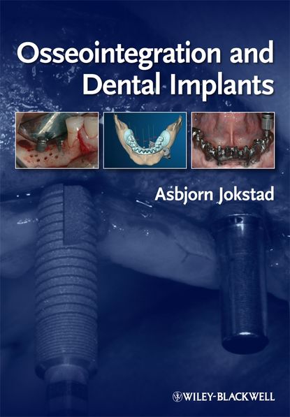 Скачать книгу Osseointegration and Dental Implants