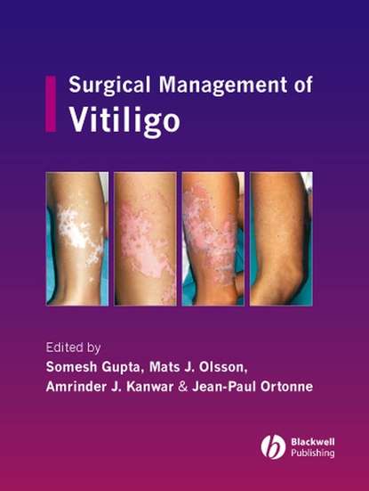 Скачать книгу Surgical Management of Vitiligo