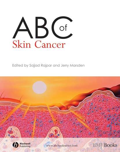 Скачать книгу ABC of Skin Cancer