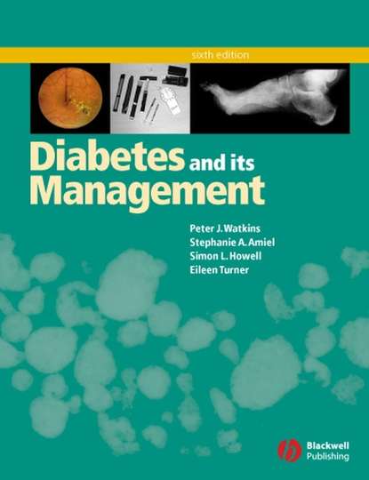 Скачать книгу Diabetes and Its Management