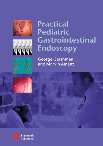 Скачать книгу Practical Pediatric Gastrointestinal Endoscopy