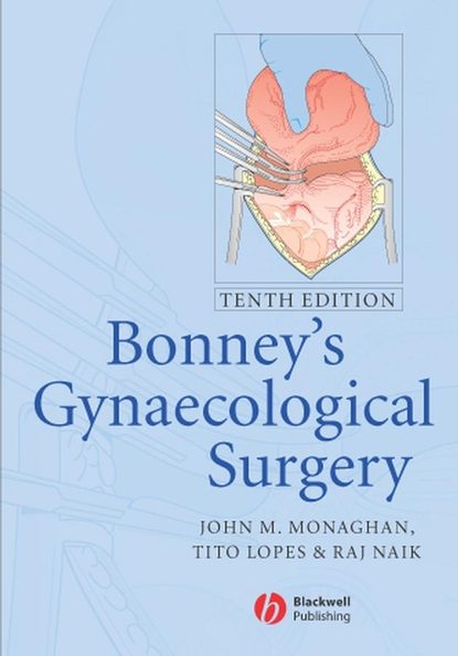 Скачать книгу Bonney's Gynaecological Surgery