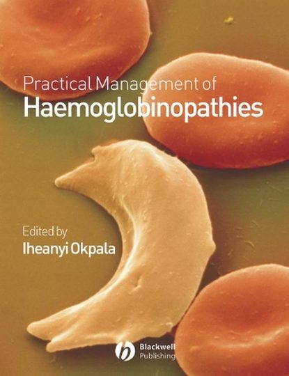 Скачать книгу Practical Management of Haemoglobinopathies