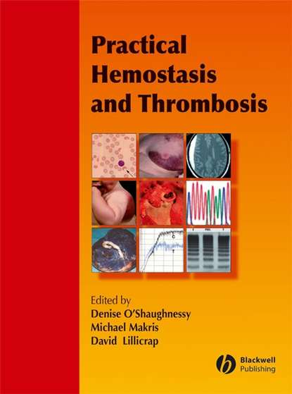 Скачать книгу Practical Hemostasis and Thrombosis