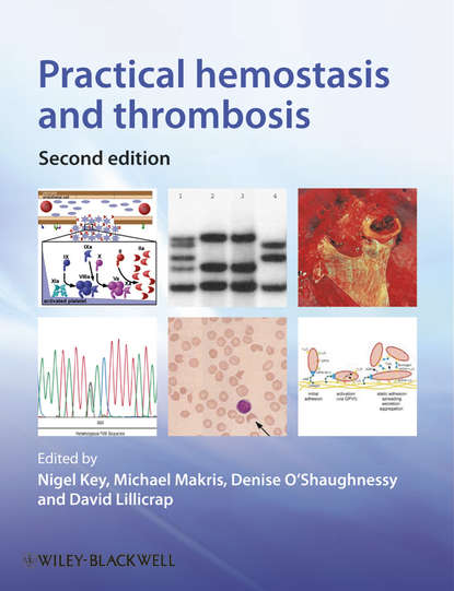 Скачать книгу Practical Hemostasis and Thrombosis