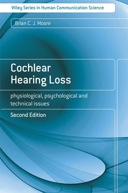 Скачать книгу Cochlear Hearing Loss