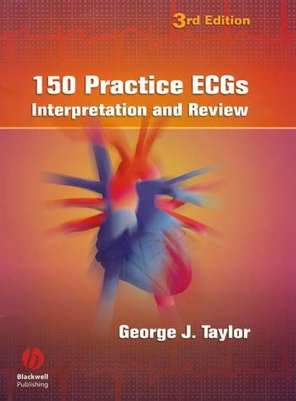 Скачать книгу 150 Practice ECGs